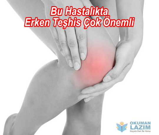 jra hastalığı